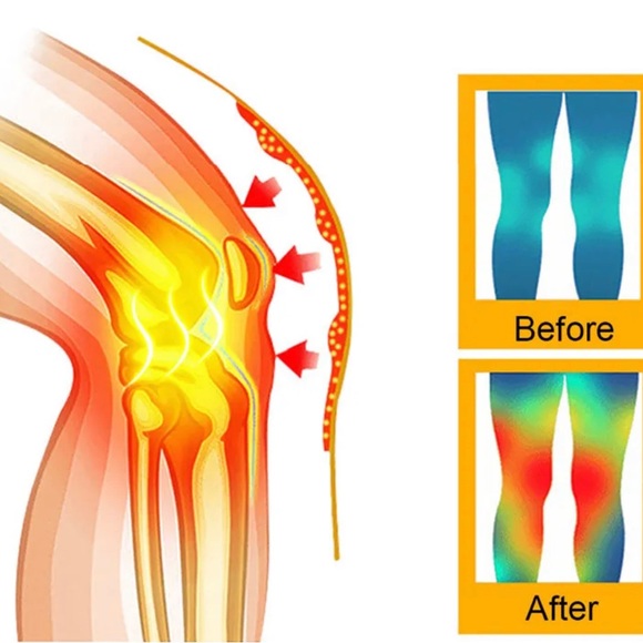 Self Heating Knee Pad Warm Socks Arthritis Joint Pain Reliefs Protection Wrap - Picture 9 of 14